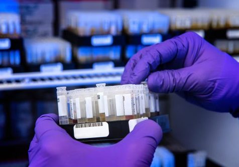 antibody testing