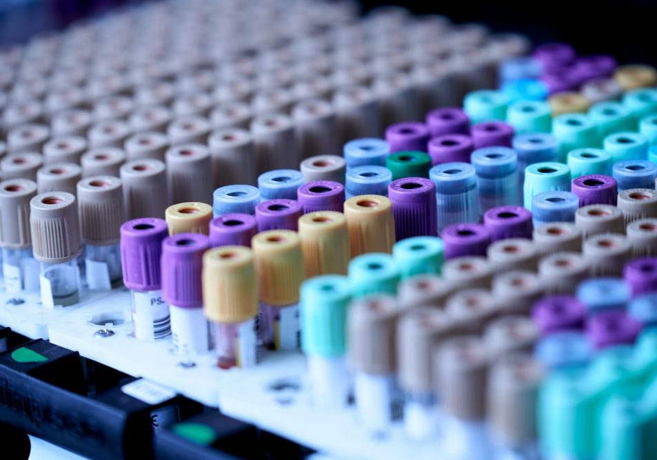 Vacutainer tubes with blood.